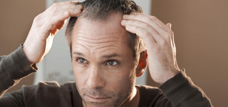 widoczne zakola u mężczyzny