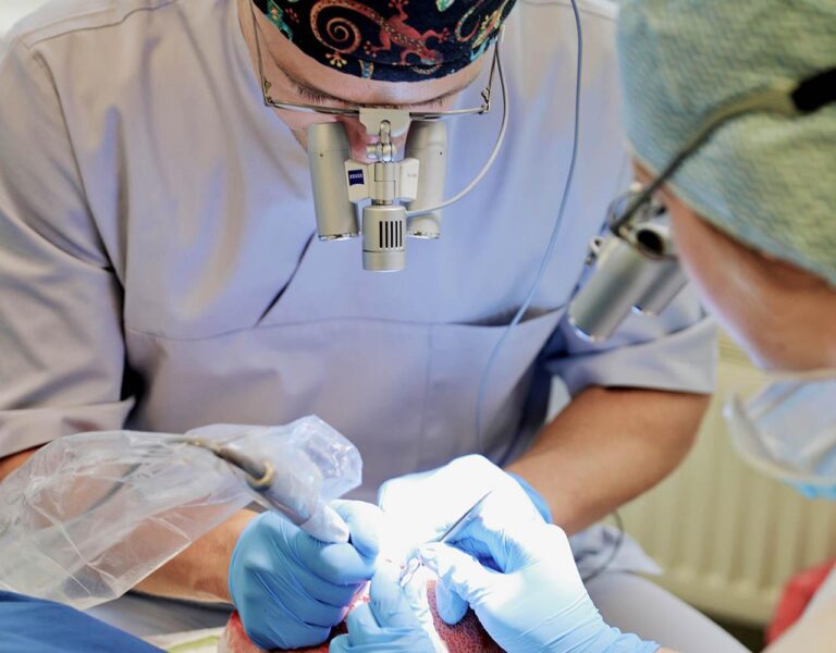 przeszczep wlosow za granica czy w polsce