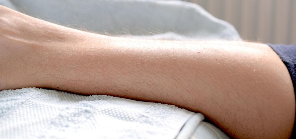 Kobieta z nadmiernym owłosieniem na nogach