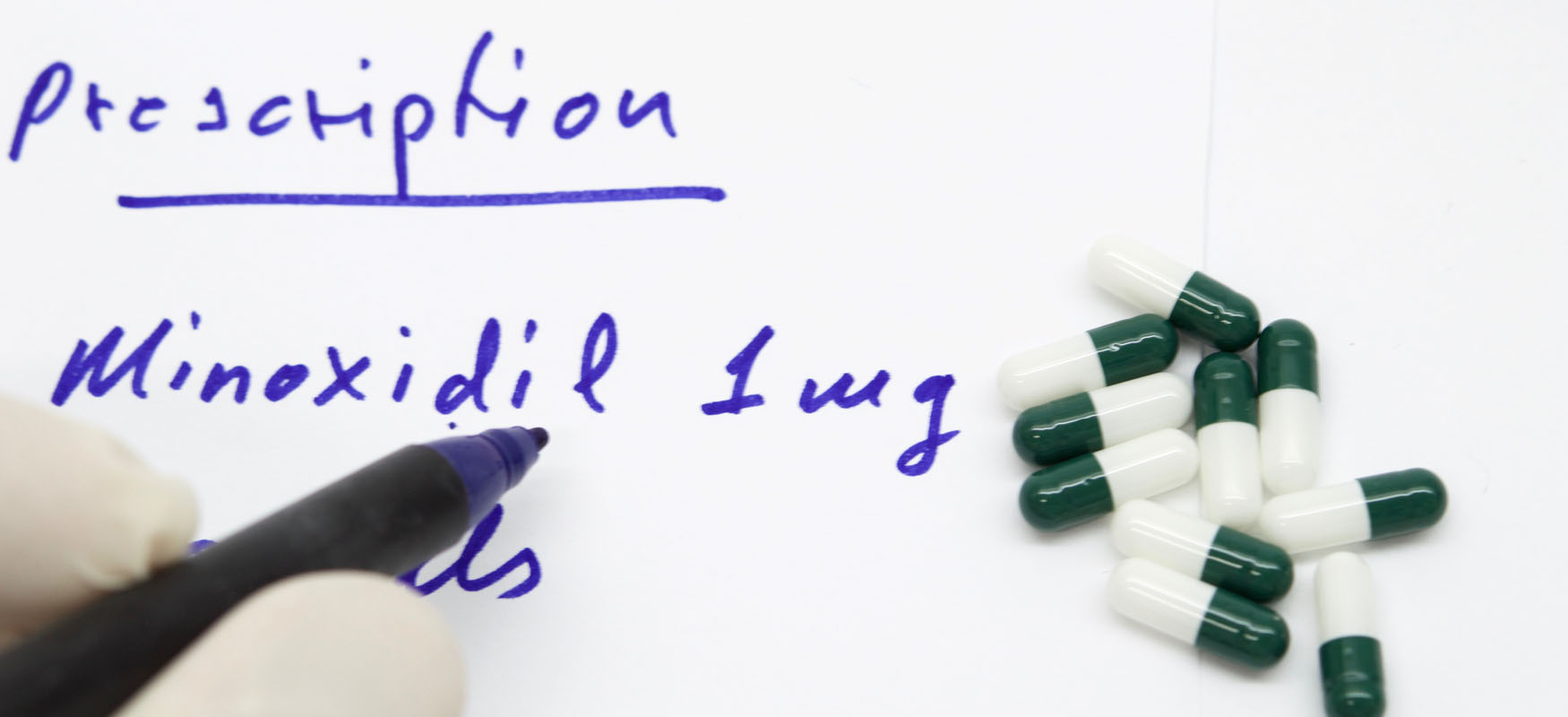 Minoxidil – stosowanie, skutki uboczne