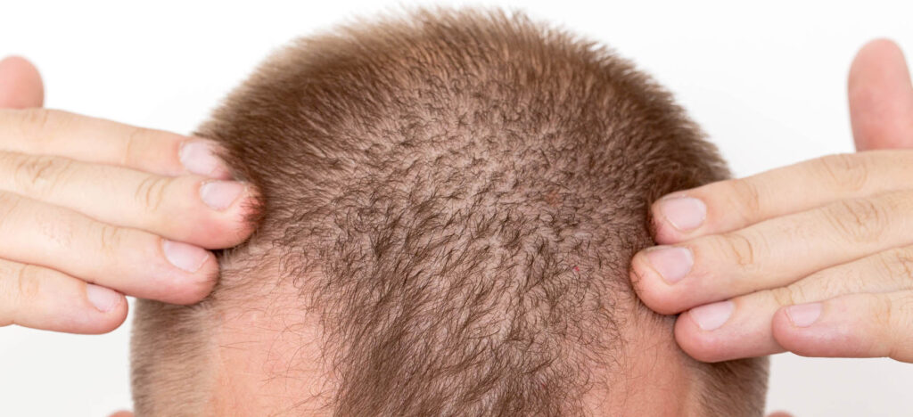 efekt działania dht