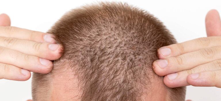 efekt działania dht