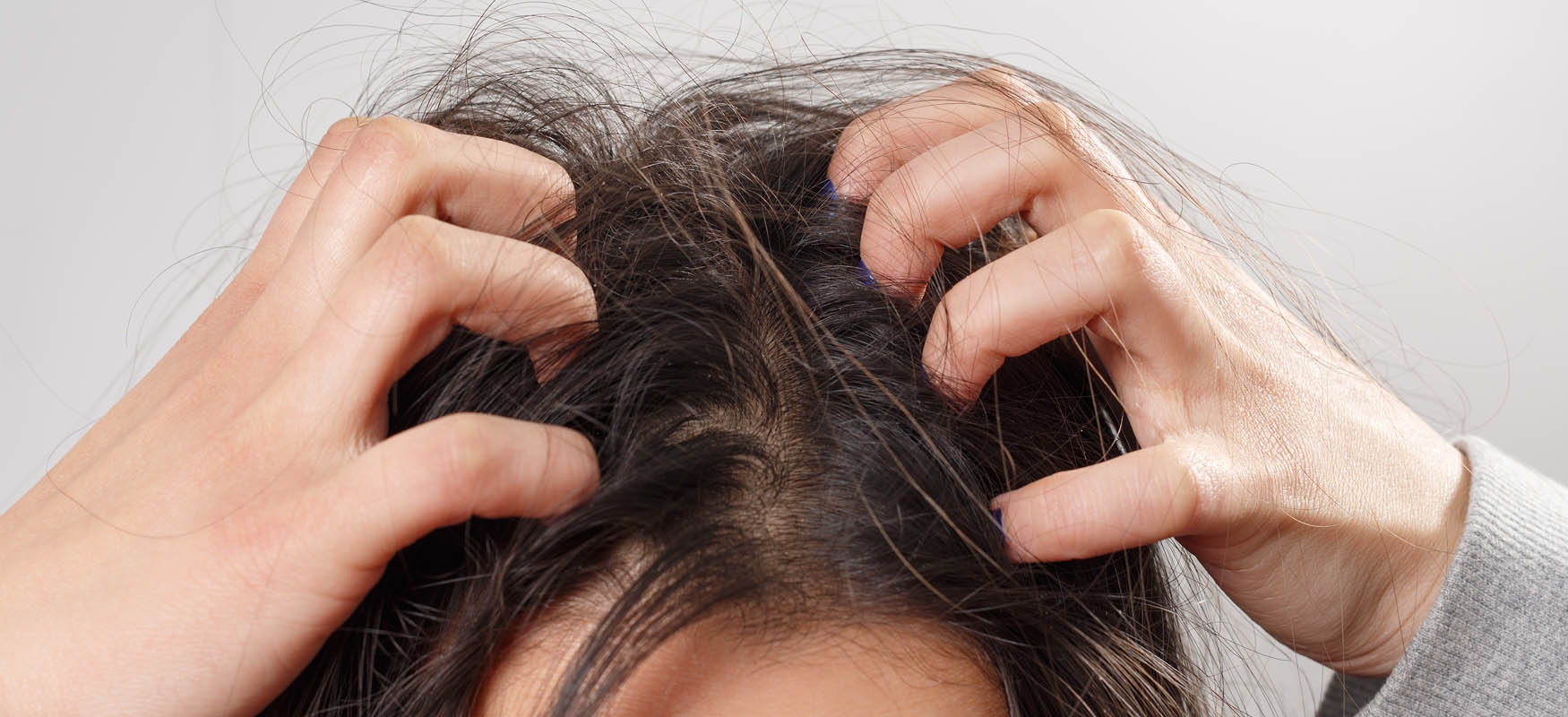 Swędzenie skóry głowy – co powoduje nieprzyjemne objawy?