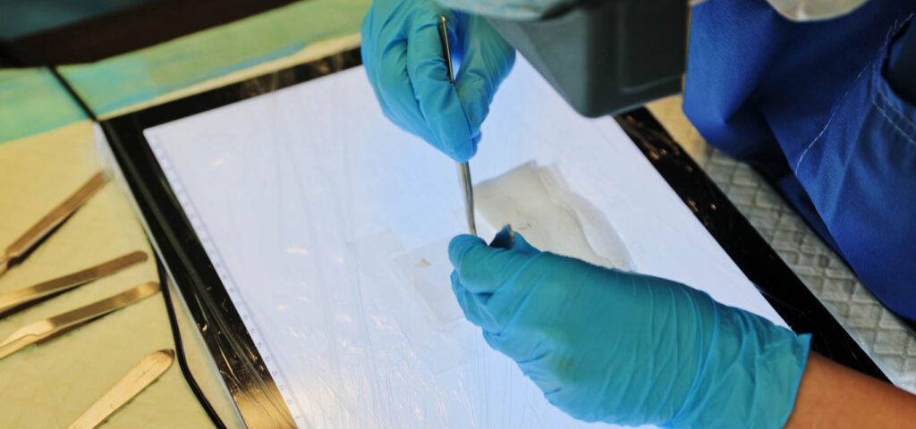 specjalista analizujący grafty pacjenta przed przeszczepem