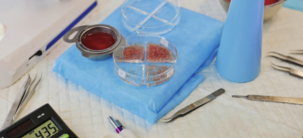 Zbliżenie na grafty włosowe przygotowane do przeszczepu włosów