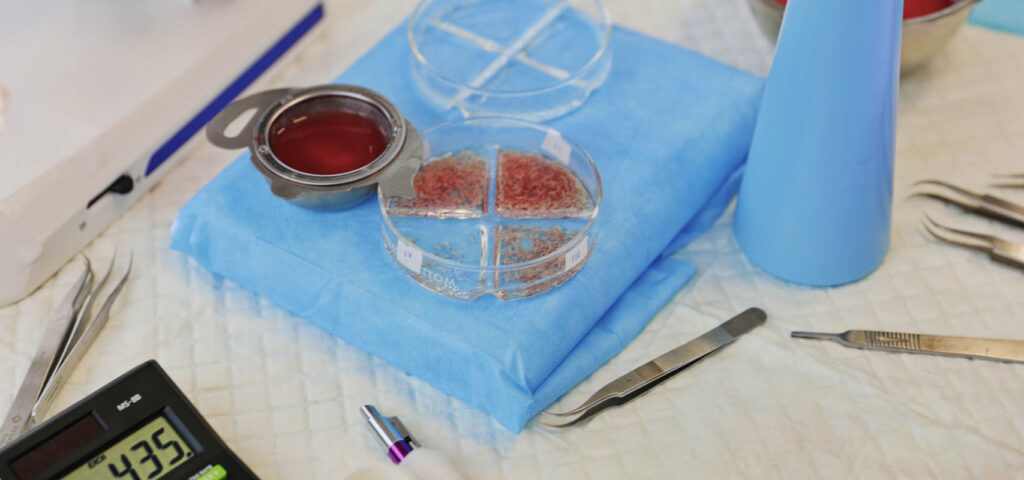 Zbliżenie na grafty włosowe przygotowane do przeszczepu włosów