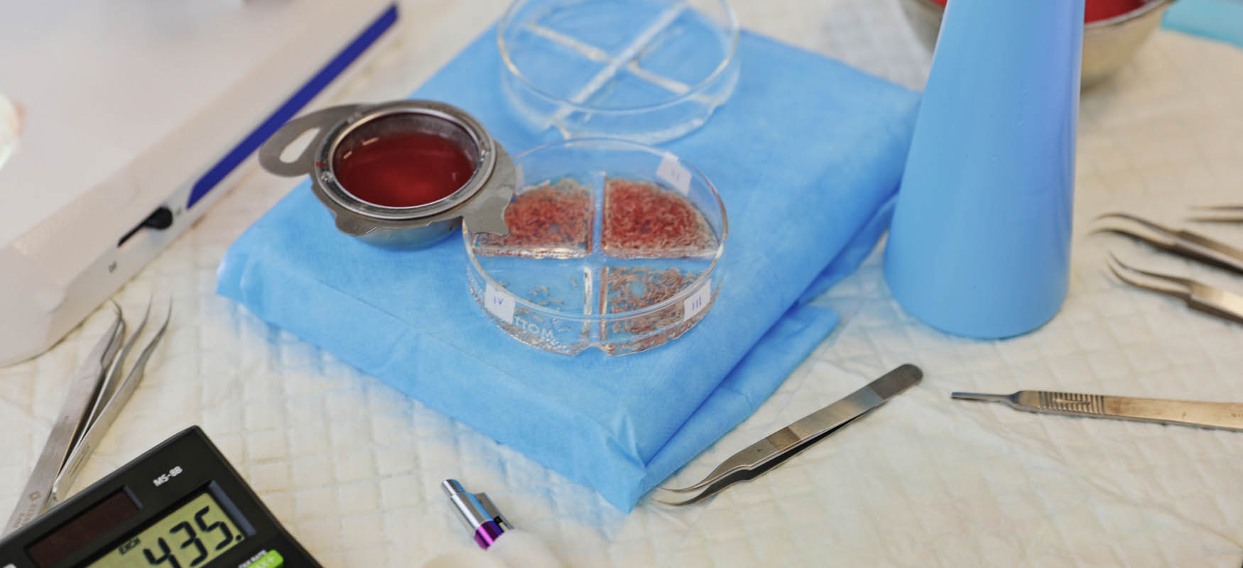 Czym są grafty i jak wygląda ich pobieranie