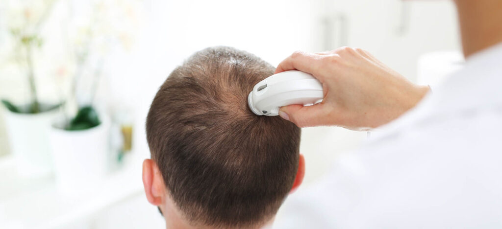 badanie wlosow skory glowy