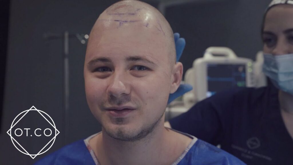 Przeszczep włosów u Dawida Blachury czyli Yachuprodukcji