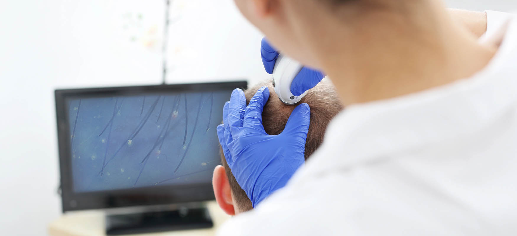 Jakie badania przy wypadaniu włosów?