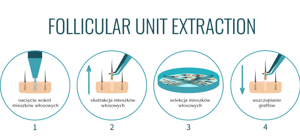 fue przebieg fue przebieg