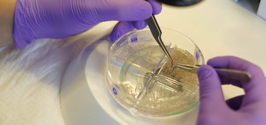 selekcja pobranych graftow selekcja pobranych graftow