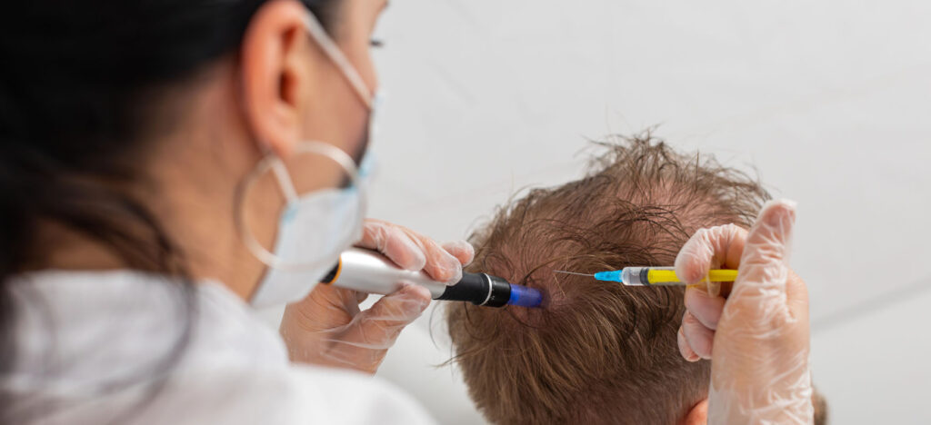 egzosomy na wlosy terapia