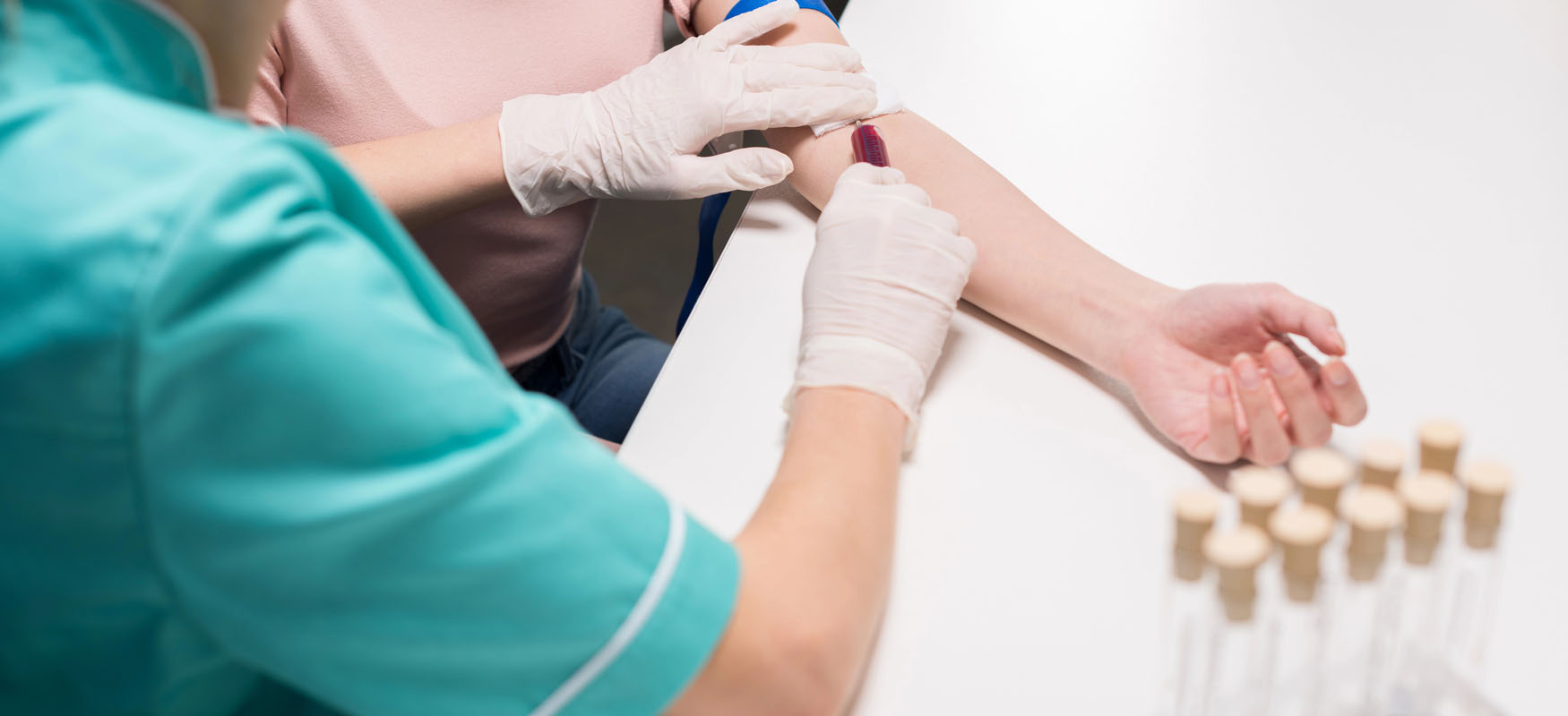 Jak ferrytyna wpływa na włosy? Sprawdź rolę żelaza