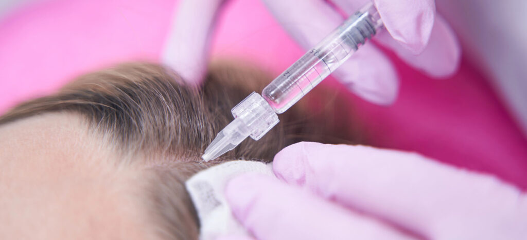 efekty mezoterapii iglowej