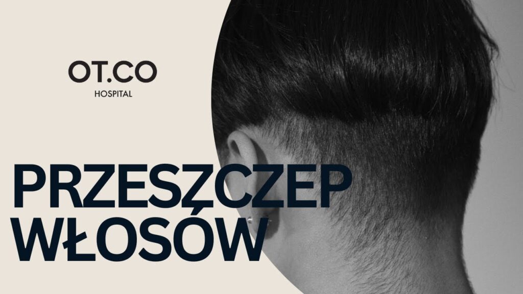 Przeszczep włosów krok po kroku – wywiad z dr. n. med. Piotrem Turkowskim
