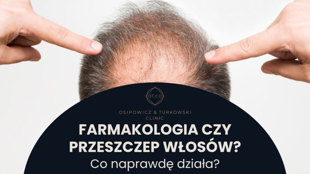 Farmakoterapia czy przeszczep włosów – co na prawdę działa