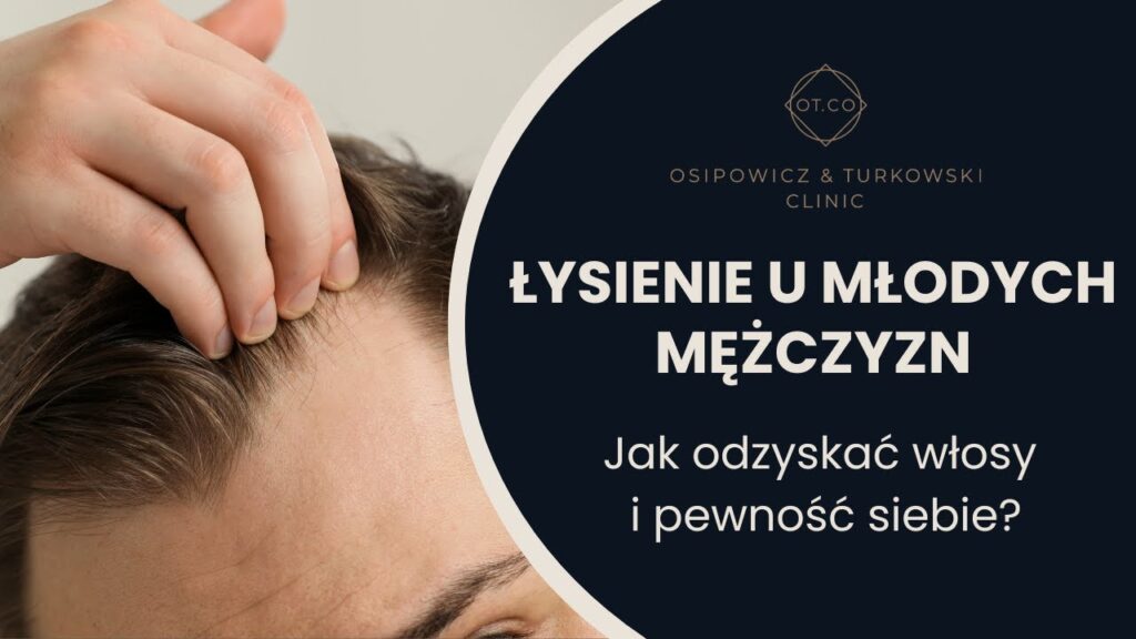 Wypadanie włosów – u młodego mężczyzny